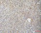 Anti-Cofilin 2/CFL2 Antibody Picoband™ (monoclonal, 8C13)